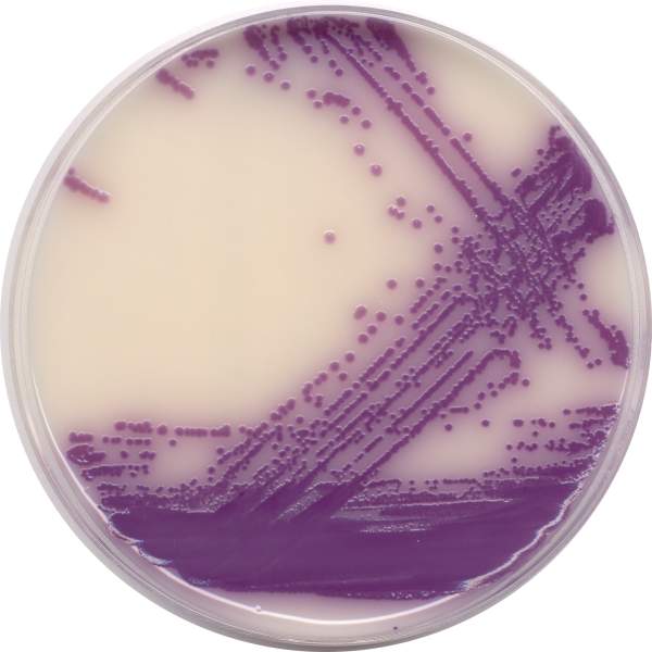 Salmonella, Listeria detection
